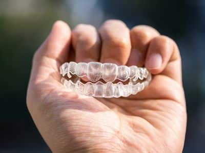 Lingual Braces Vs Traditional Braces