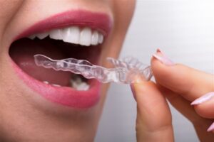 Dos and Donts for Aligners: Proven Strategies for Success