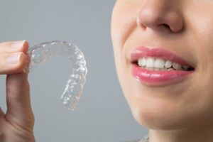 Invisalign Costs Explained